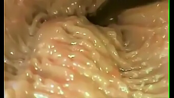 Vaginal Pe...